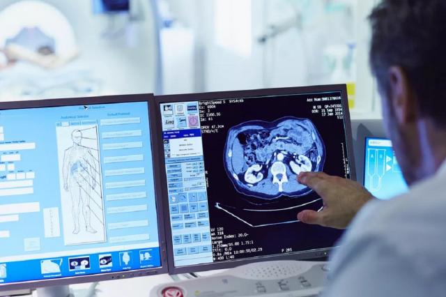 ABŞ alimləri kreatinin beyin fəaliyyəti üçün faydalarından danışıblar