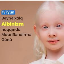 İyunun 13-ü Beynəlxalq Albinizm haqqında Maarifləndirmə Günüdür  