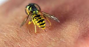  Arı sancmaları zamanı nə etməli?   