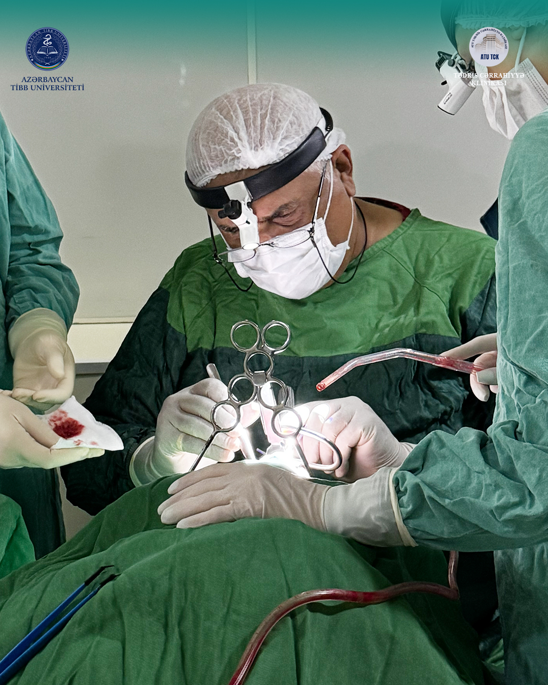  Tez-tez angina və xoruldama ciddi problemin əlaməti ola bilər   