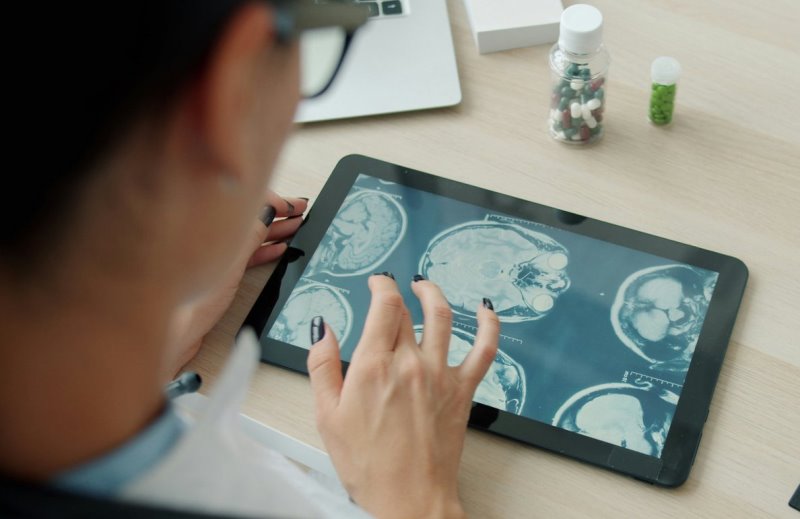 Süni intellekt Parkinson xəstəliyinin gizli strukturunu üzə çıxardı