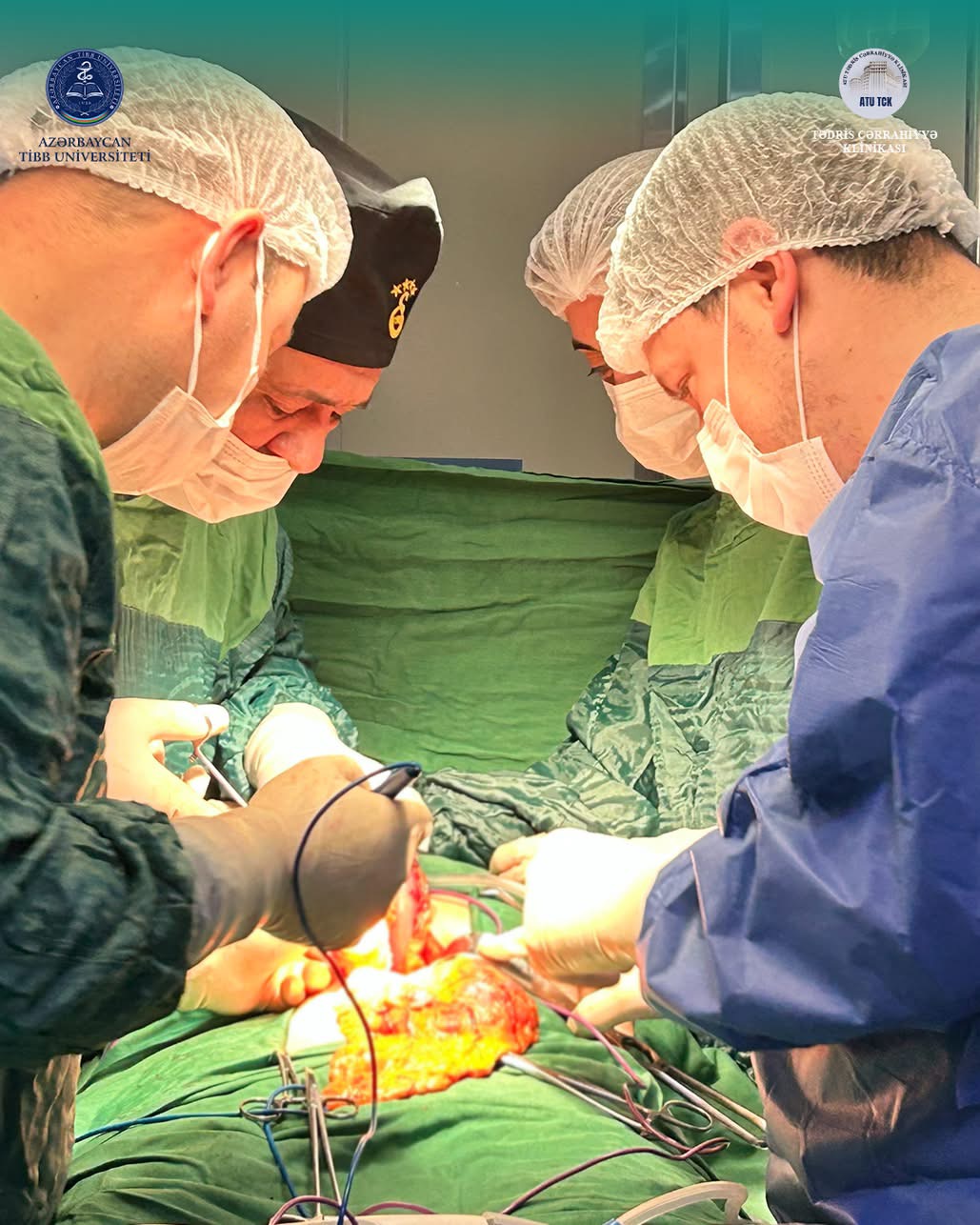 Tədris Cərrahiyyə Klinikasında növbəti uğurlu cərrahi müdaxilə