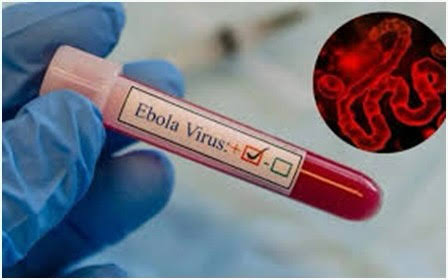 Uqanda Ebola təhlükəsinə görə Konqo ilə sərhədini bağlayıb