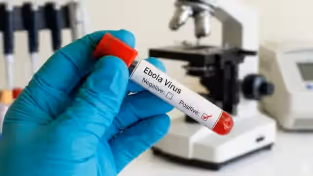 Konqoda Ebola virusundan ölənlərin sayı 250-ni ötüb  