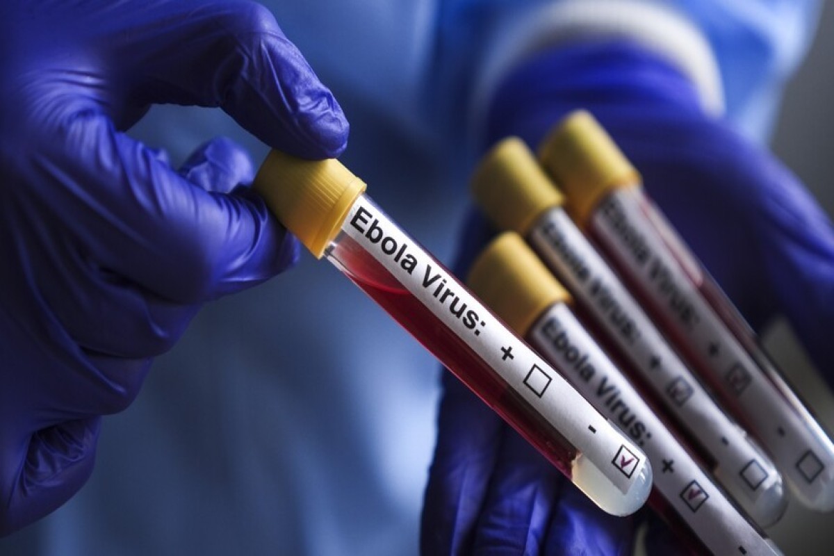Azərbaycanda Ebola xəstəliyinin yayılması riski aşağı qiymətləndirilir  