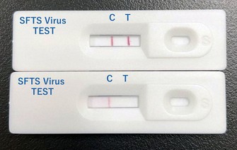 Yaponiyada ölümcül gənə virusunu bir neçə saata aşkar edən test hazırlanır  