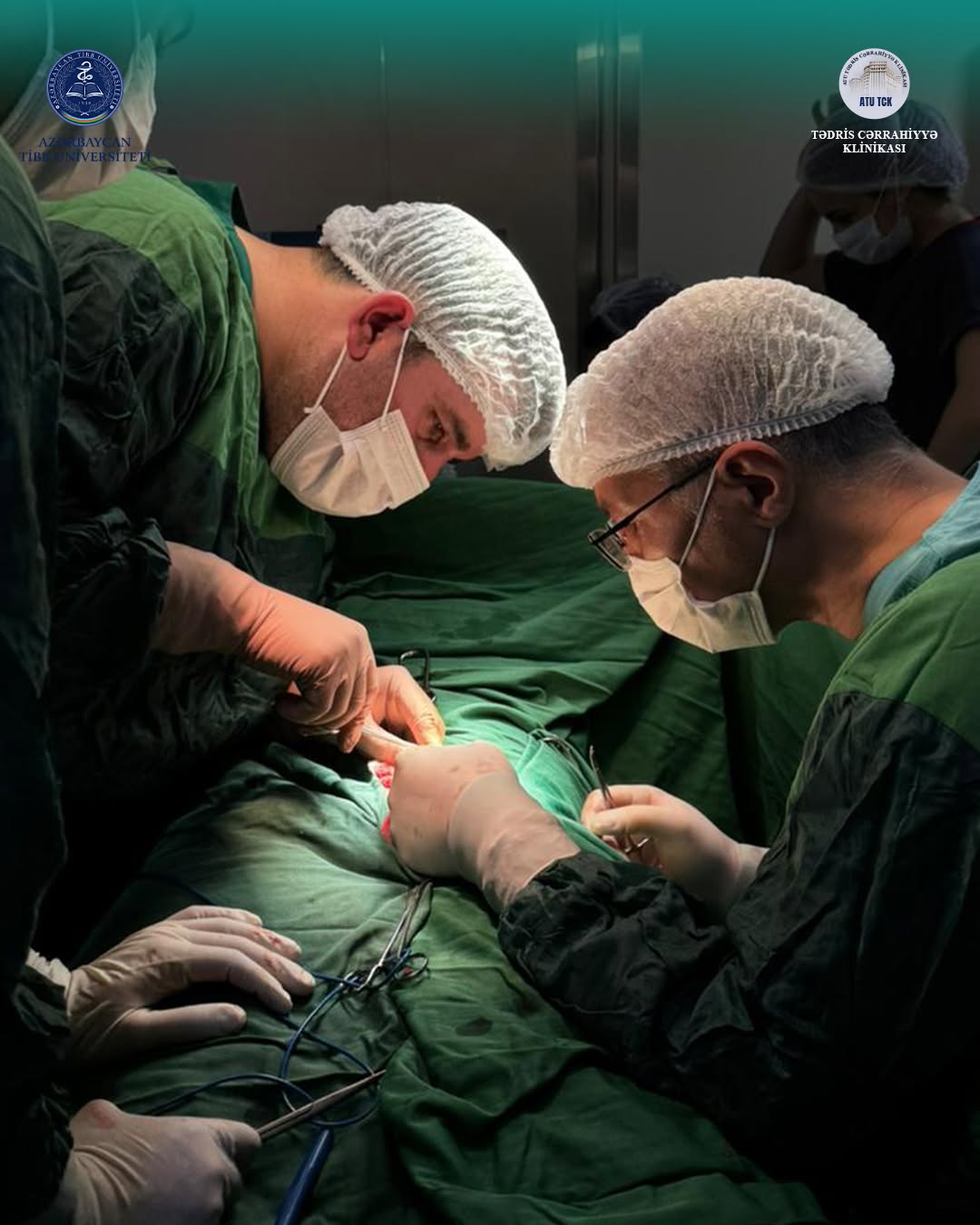 Varikosel diaqnozu ilə müraciət edən pasiyent üzərində uğurlu cərrahi əməliyyat icra edilib - Tədris Cərrahiyyə Klinikası