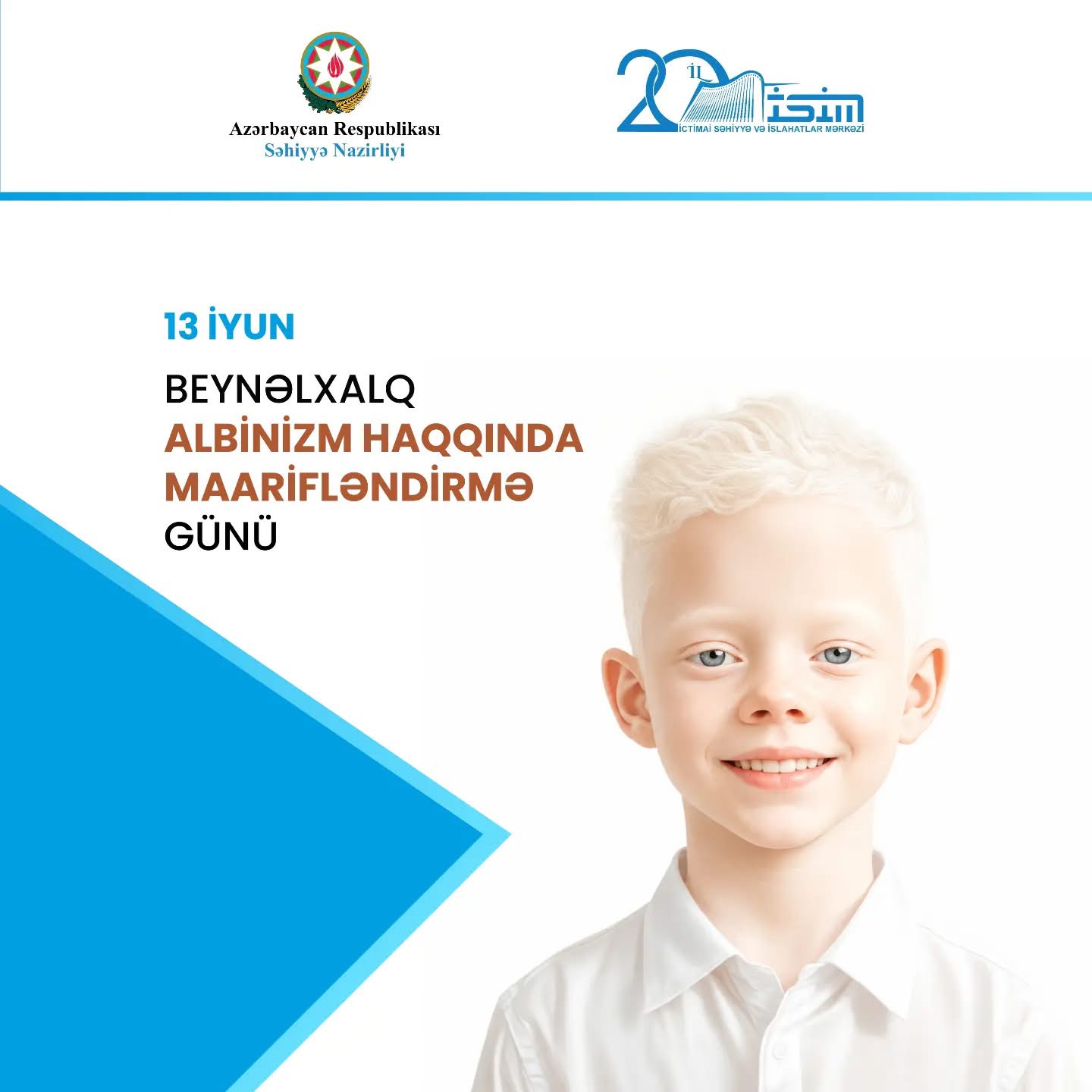 13 İyun - Beynəlxalq Albinizm haqqında Maarifləndirmə Günüdür