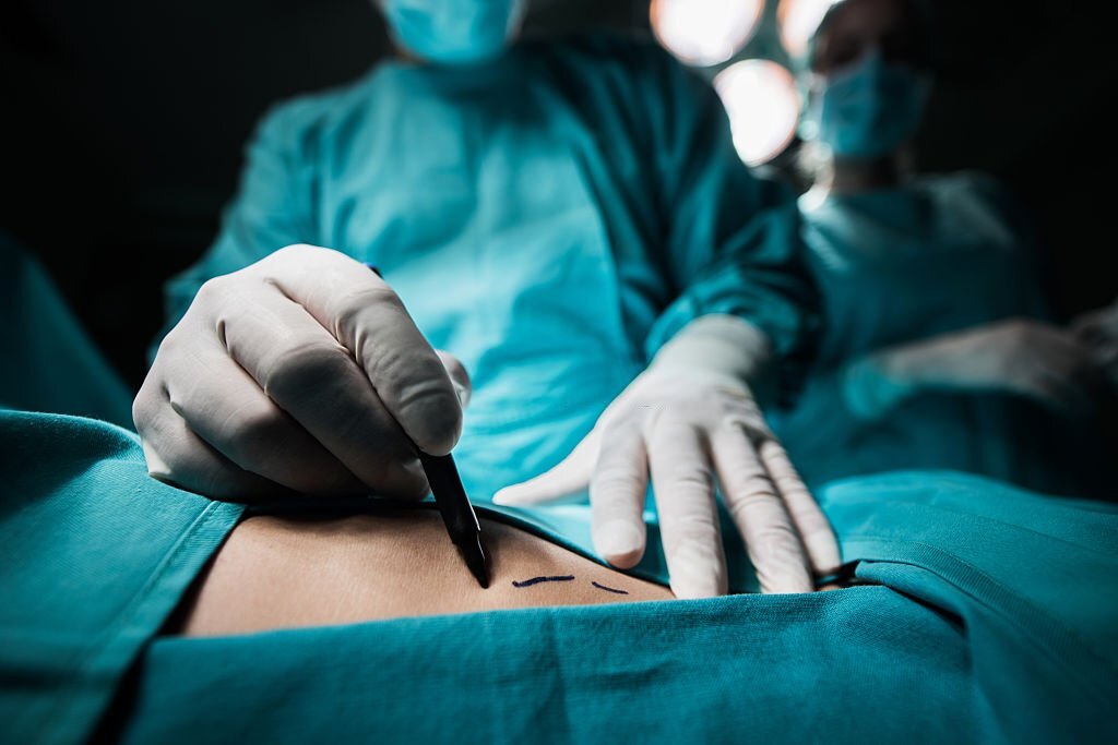 ADHTİ-nin Plastik və Rekonstruktiv Cərrahiyyə klinikasında ölkəmizdə ilk dəfə olaraq unikal əməliyyat icra olunub