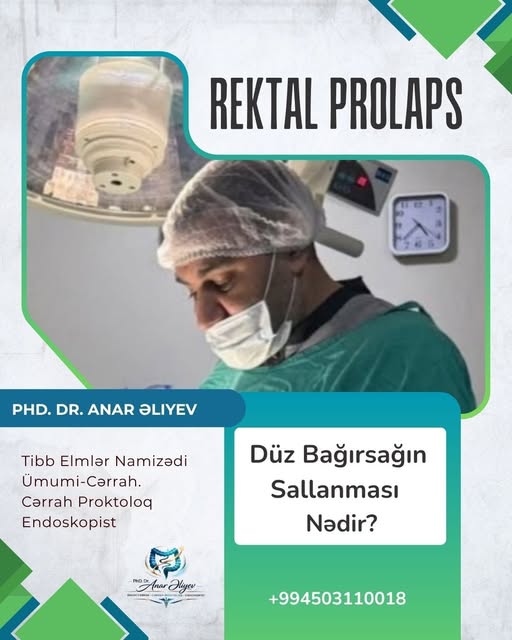 Düz bağırsağın sallanması nədir?