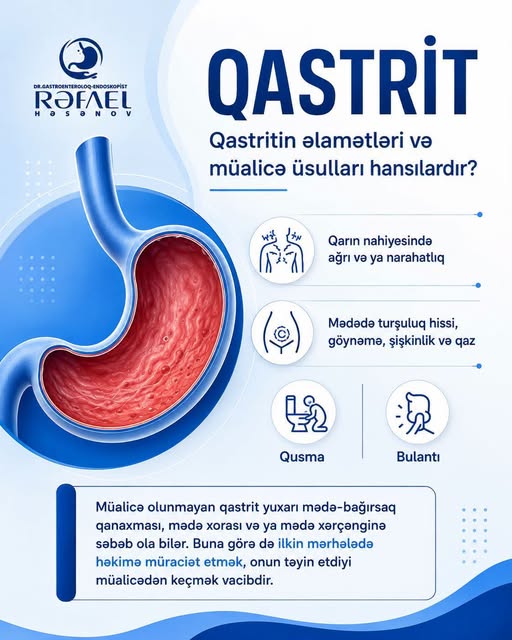 Qastritin bu əlamətlərini görməzliyə vurmayın – Həkimdən xəbərdarlıq