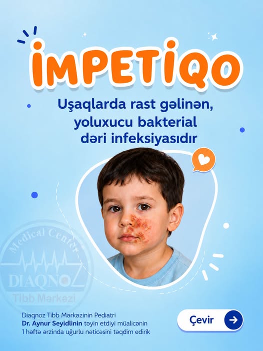 İmpetiqo - Uşaqlarda yoluxucu dəri infeksiyasına diqqət!