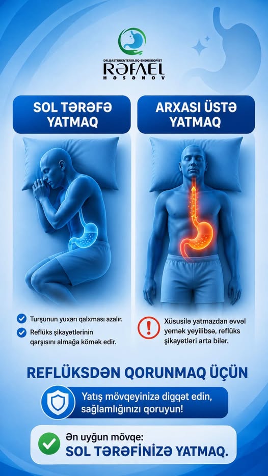 Reflüksdən əziyyət çəkənlər necə yatmalıdır? – Həkimdən vacib tövsiyə