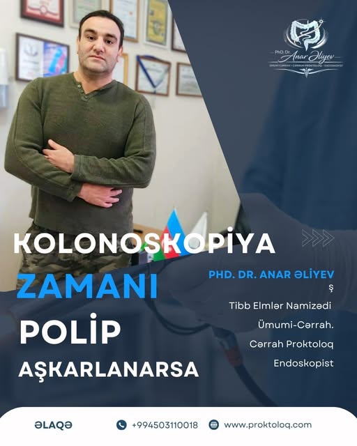 Kolonoskopiya zamanı polip aşkar edilərsə nə etməli? - Cərrah-proktoloq izah etdi