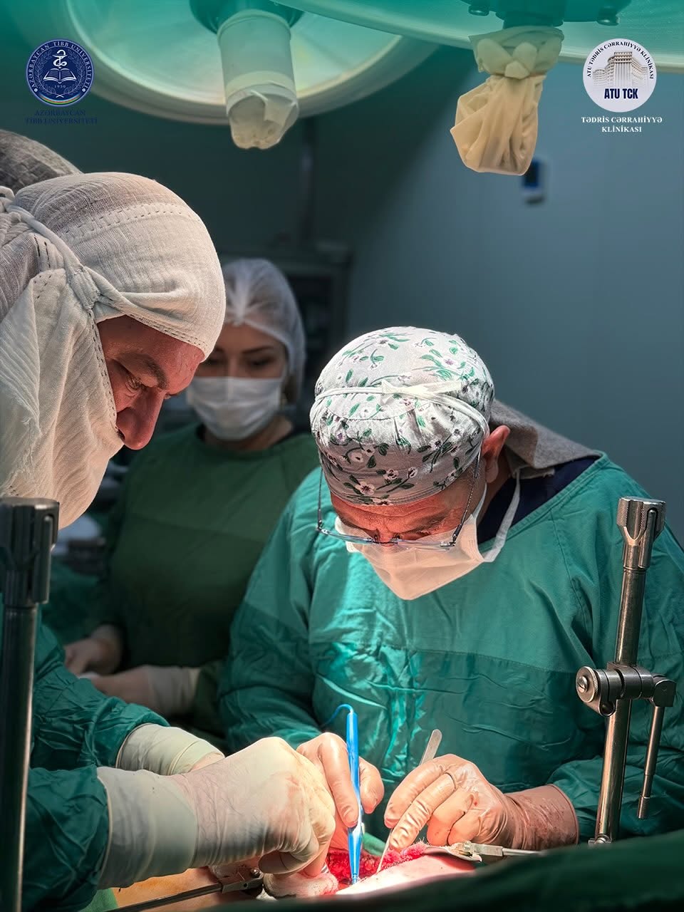 Laparoskopik xolesistektomiya zamanı öd yolları zədələnən pasiyentə rekonstruktiv cərrahi əməliyyat icra olunub