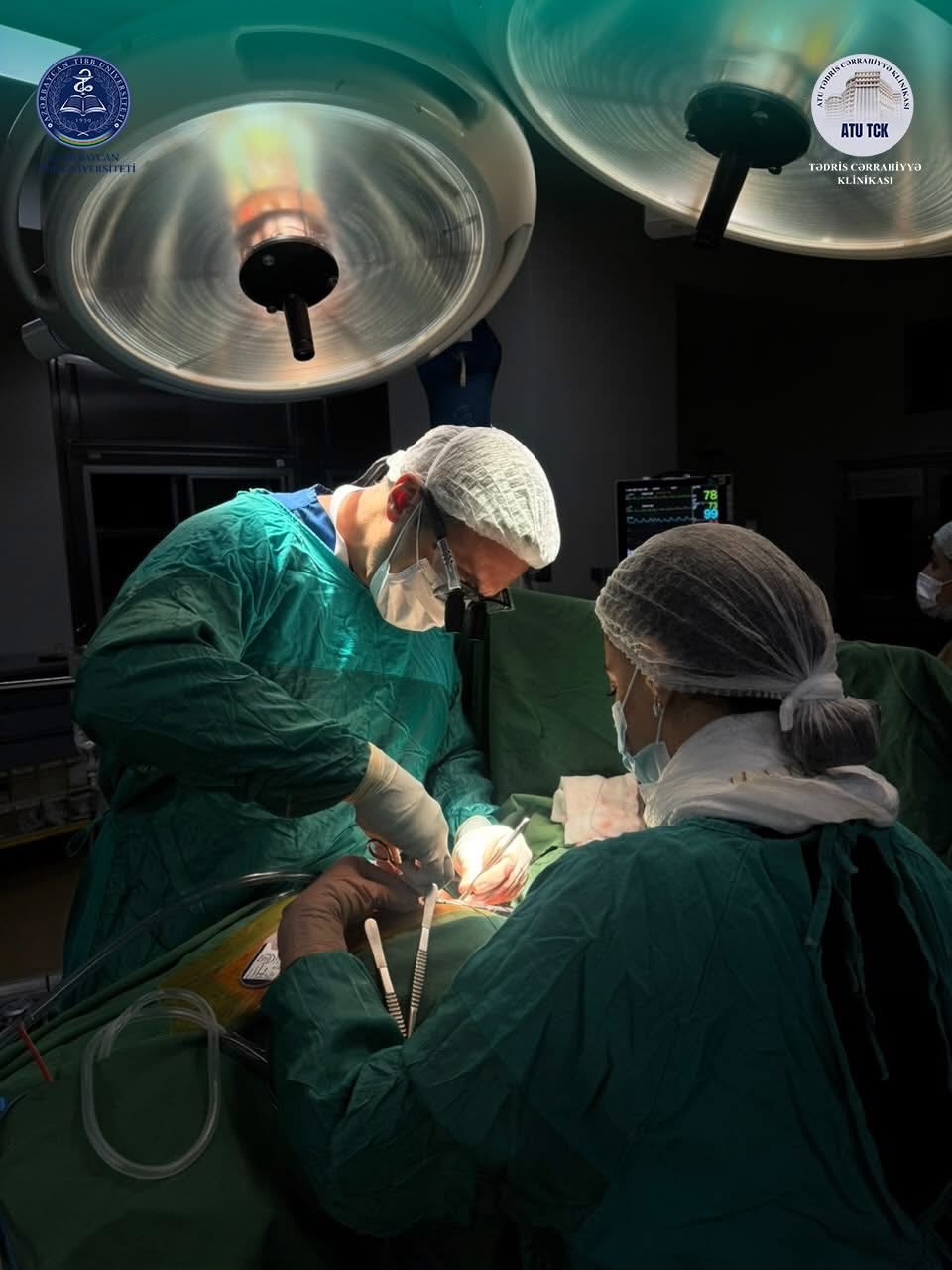 Koronar arteriyaların çoxdamarlı stenozu diaqnozu qoyulan pasiyent üzərində uğurlu aorta-koronar şuntlama əməliyyatı