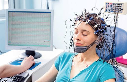 Epilepsiyaya səbəb olan beyin anomaliyalarını yeni üsulla aşkarlanır - Süni intellekt alqoritmi