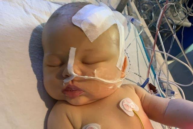 Dırnağındakı kiçik infeksiya 11 günlük körpədə beyin şişini üzə çıxardı