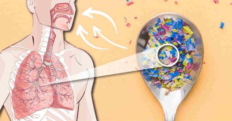 Xərçəngli ağciyərlərdə daha çox mikroplastik aşkarlanır - 
