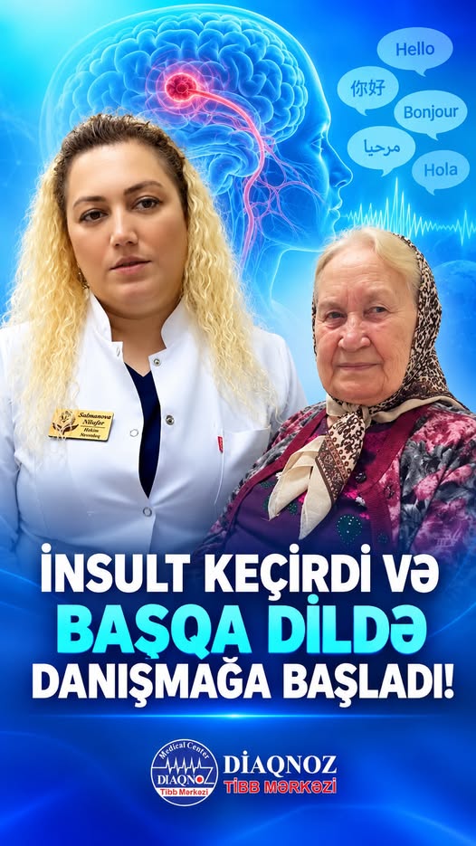                   İnsultdan sonra nitqdə qeyri-adi dəyişiklik - Beyin dil bacarıqlarına təsir edir?                      