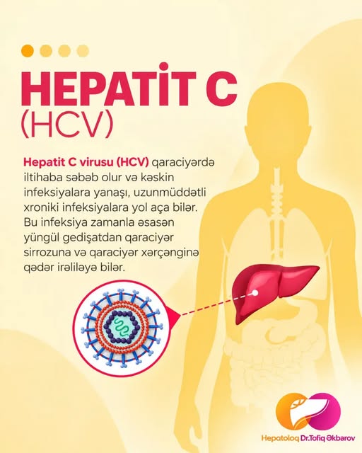 Hepatoloq: Hepatit C qaraciyər sağlamlığına gizli təhdiddir