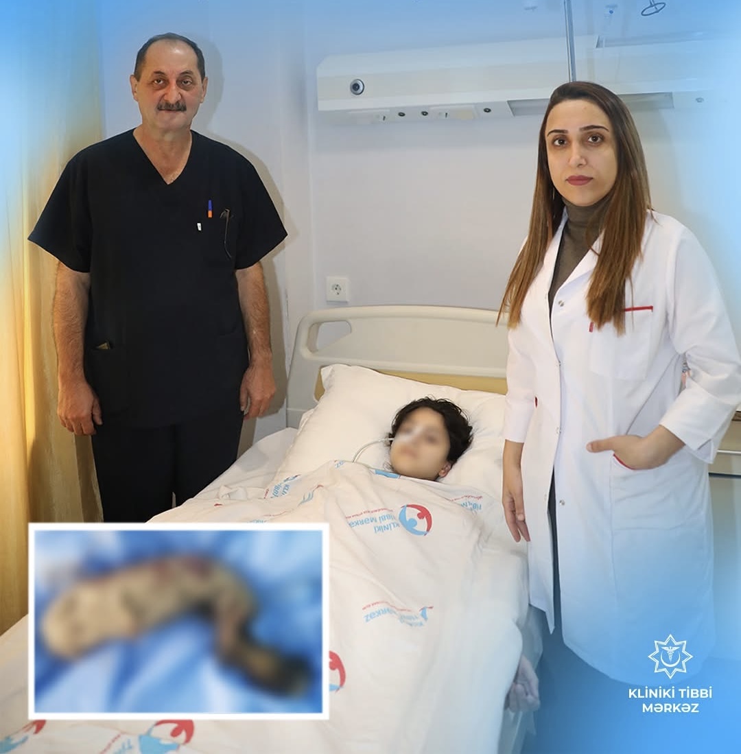 KTM-də yeniyetmənin mədə-bağırsağından saç kütləsi çıxarıldı